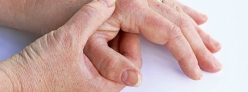 Pesquisa revela impactos da artrite reumatoide em pacientes